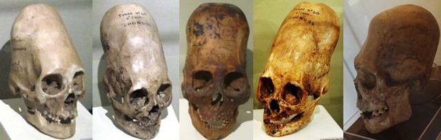 Kết quả phân tích ADN hộp sọ Paracas: Không phải của con người 6