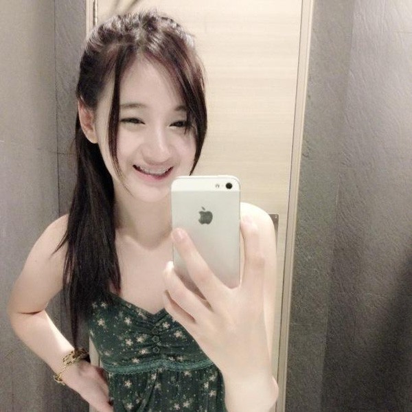Thanh niên quyết định chia tay bạn gái niềng răng vì bị sứt môi khi hôn nhau - Ảnh 3. Thanh niên quyết định chia tay bạn gái niềng răng vì bị sứt môi khi hôn nhau 3