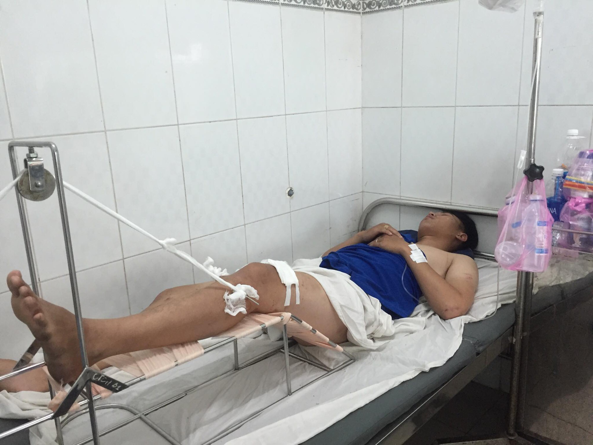 Vụ tai nạn kinh hoàng ở Sài Gòn : Thêm 1 nạn nhân nguy kịch - Ảnh 4. Thêm 1 nạn nhân nguy kịch trong vụ tai nạn xe ben tông hàng loạt ở TP.HCM 3