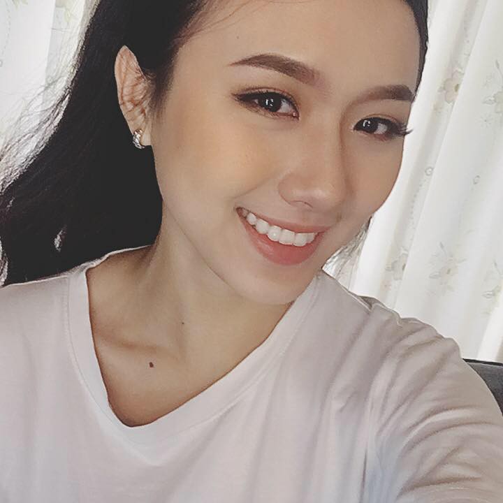 Sức mạnh của niềng răng: Cô bé trở nên xinh đẹp như hot girl sau 4 năm chịu đựng - Ảnh 3. Sức mạnh của niềng răng: Cô bé trở nên xinh đẹp như hot girl sau 4 năm chịu đựng 3
