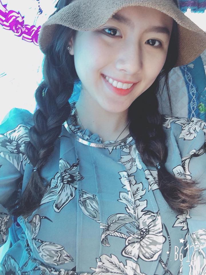 Sức mạnh của niềng răng: Cô bé trở nên xinh đẹp như hot girl sau 4 năm chịu đựng - Ảnh 4. Sức mạnh của niềng răng: Cô bé trở nên xinh đẹp như hot girl sau 4 năm chịu đựng 4