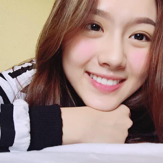 Sức mạnh của niềng răng: Cô bé trở nên xinh đẹp như hot girl sau 4 năm chịu đựng - Ảnh 7. Sức mạnh của niềng răng: Cô bé trở nên xinh đẹp như hot girl sau 4 năm chịu đựng 7
