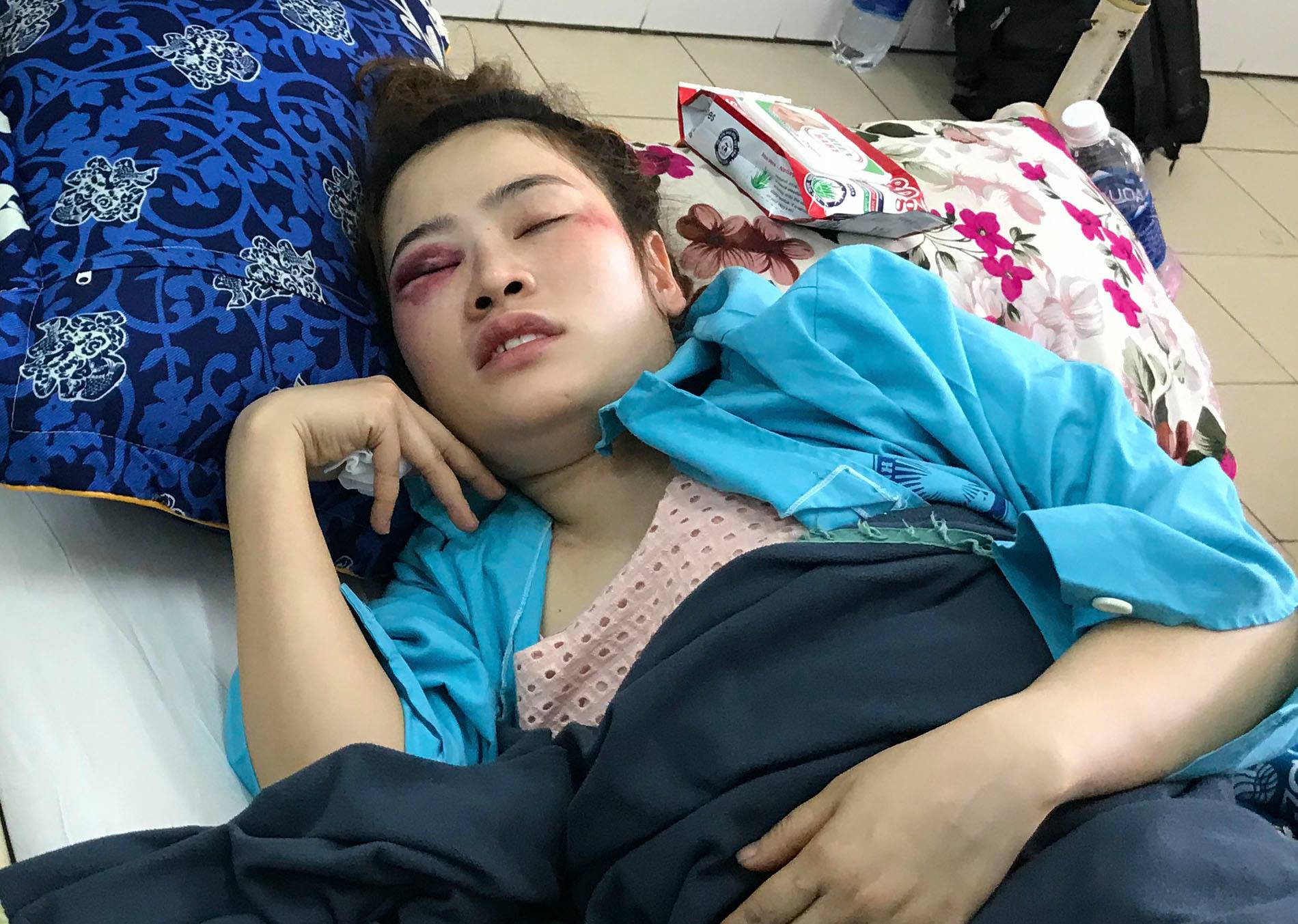 Vụ cô gái bị đánh nhập viện vì tranh bánh xèo: Nam thanh niên là cháu ruột trưởng công an phường, muốn gửi lời xin lỗi nạn nhân - Ảnh 1. Cháu đánh cô gái nhập viện vì tranh bánh xèo, trưởng công an phường: 'Tôi không đi xe công vì việc tư' 1