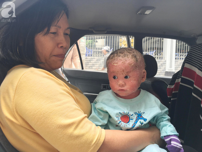 Ca sĩ Lam Trường đến thăm bé Bích - em bé bị vẩy ngứa da trăn trước khi bé nhập viện điều trị - Ảnh 9. Ca sĩ Lam Trường đến thăm bé Bích - em bé bị vẩy ngứa da trăn trước khi bé nhập viện điều trị 9