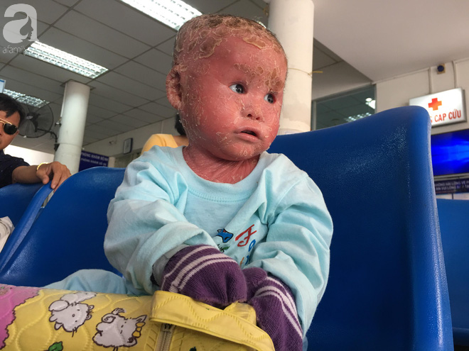 Ca sĩ Lam Trường đến thăm bé Bích - em bé bị vẩy ngứa da trăn trước khi bé nhập viện điều trị - Ảnh 7. Ca sĩ Lam Trường đến thăm bé Bích - em bé bị vẩy ngứa da trăn trước khi bé nhập viện điều trị 7