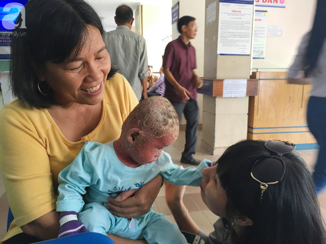 Ca sĩ Lam Trường đến thăm bé Bích - em bé bị vẩy ngứa da trăn trước khi bé nhập viện điều trị - Ảnh 6. Ca sĩ Lam Trường đến thăm bé Bích - em bé bị vẩy ngứa da trăn trước khi bé nhập viện điều trị 6