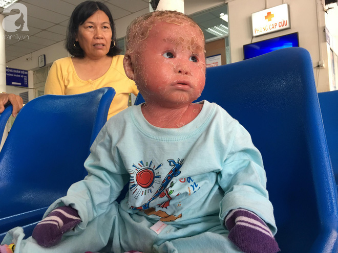 Ca sĩ Lam Trường đến thăm bé Bích - em bé bị vẩy ngứa da trăn trước khi bé nhập viện điều trị - Ảnh 12. Ca sĩ Lam Trường đến thăm bé Bích - em bé bị vẩy ngứa da trăn trước khi bé nhập viện điều trị 12