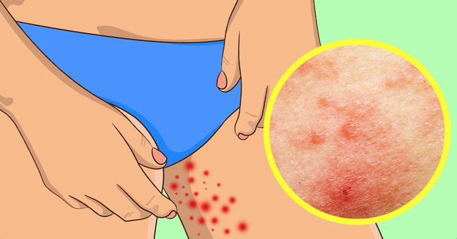 Điểm mặt triệu chứng bệnh thường gặp mùa hè: Số 8 rất dễ phát triển thành ung thư - Ảnh 1. Điểm mặt triệu chứng bệnh thường gặp mùa hè: Số 8 rất dễ phát triển thành ung thư 2