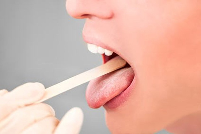 90% người từng bị khô và đau họng sau khi ngủ dậy: Nhớ 8 nguyên nhân phổ biến để tránh - Ảnh 3. 90\% người từng bị khô và đau họng sau khi ngủ dậy: Nhớ 8 nguyên nhân phổ biến để tránh 2