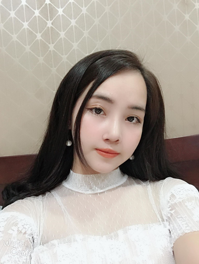 Từng bị bạn bè cầm chổi ném vì xấu xí, cô gái Hà Nội lột xác sau phẫu thuật thẩm mỹ lại lấy được chồng như ý - Ảnh 5. Từng bị bạn bè cầm chổi ném vì xấu xí, cô gái Hà Nội lột xác sau phẫu thuật thẩm mỹ lại lấy được chồng như ý 5