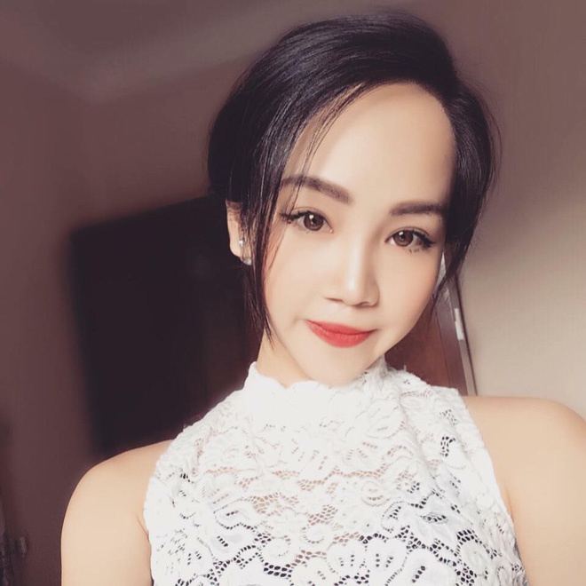 Từng bị bạn bè cầm chổi ném vì xấu xí, cô gái Hà Nội lột xác sau phẫu thuật thẩm mỹ lại lấy được chồng như ý - Ảnh 8. Từng bị bạn bè cầm chổi ném vì xấu xí, cô gái Hà Nội lột xác sau phẫu thuật thẩm mỹ lại lấy được chồng như ý 8