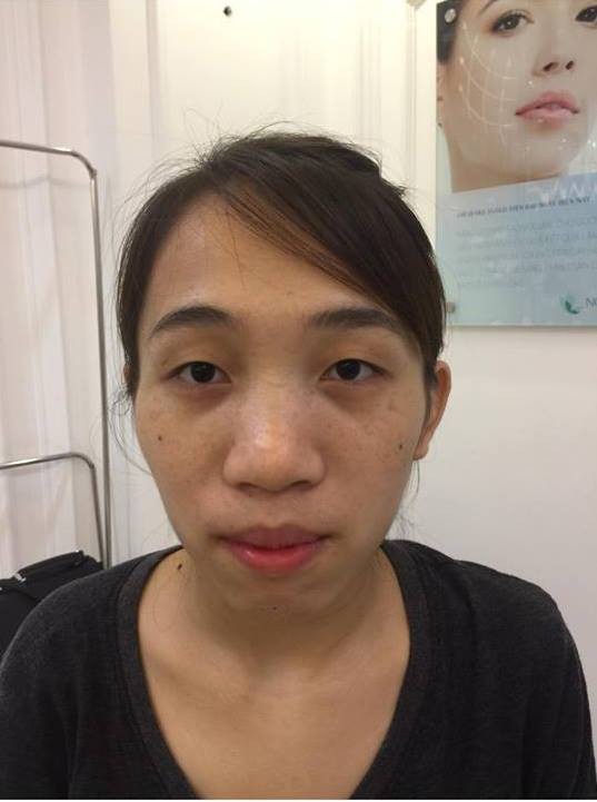 Cuộc sống của những cô gái từng bị chê là 'khỉ', 'vượn', 'Thị Nở' sau khi lột xác ngoạn mục nhờ dao kéo 21 Cuộc sống của những cô gái từng bị chê là 'khỉ', 'vượn', 'Thị Nở' sau khi lột xác ngoạn mục nhờ dao kéo 21