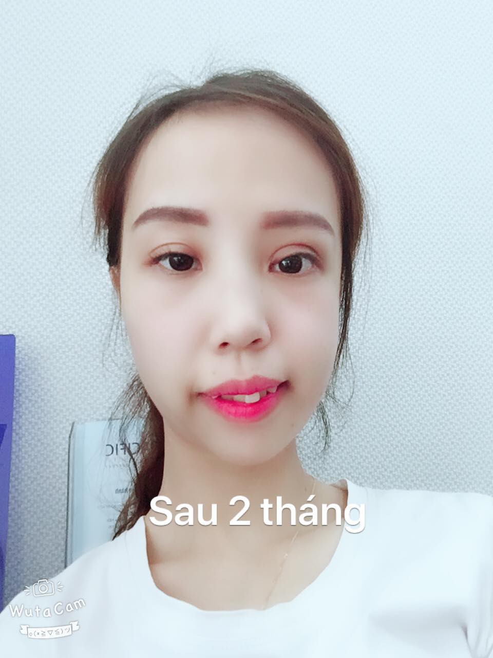 Cuộc sống của những cô gái từng bị chê là 'khỉ', 'vượn', 'Thị Nở' sau khi lột xác ngoạn mục nhờ dao kéo 13 Cuộc sống của những cô gái từng bị chê là 'khỉ', 'vượn', 'Thị Nở' sau khi lột xác ngoạn mục nhờ dao kéo 13