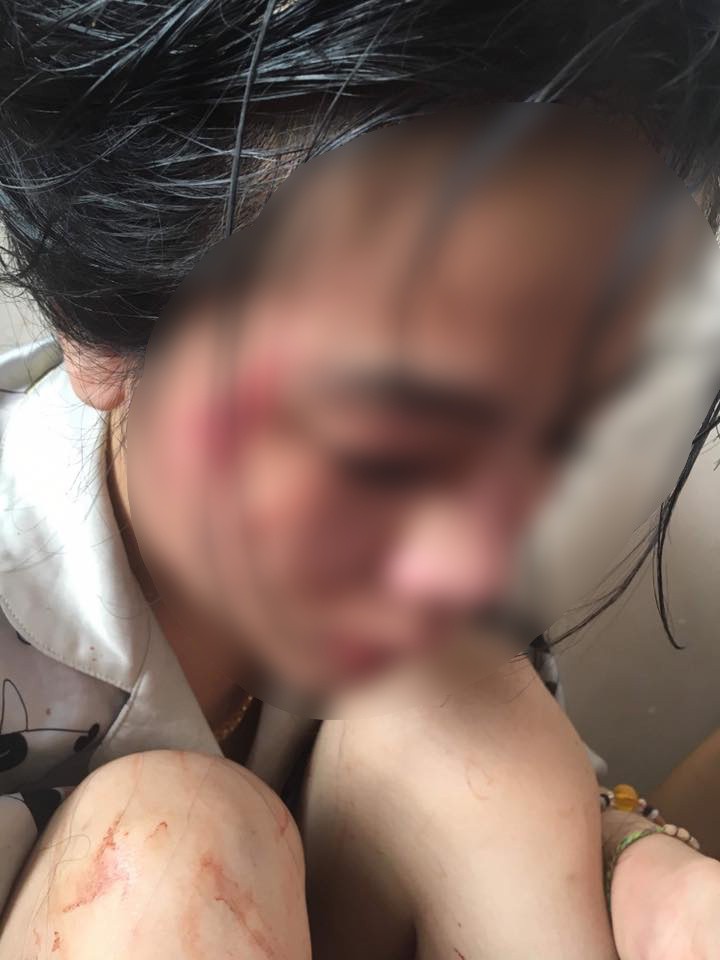 Cô gái trong clip bị cắt tóc, đánh ghen gây xôn xao MXH lên tiếng: Mong cơ quan chức năng giúp tôi lấy lại danh dự - Ảnh 2. Cô gái trong clip bị cắt tóc, đánh ghen gây xôn xao MXH lên tiếng: 'Mong cơ quan chức năng giúp tôi lấy lại danh dự' 2