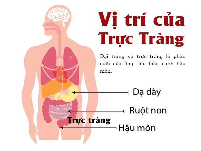 5 dấu hiệu điển hình cảnh báo khối u ung thư đại trực tràng đang phát triển thần tốc - Ảnh 2. 5 dấu hiệu điển hình cảnh báo khối u ung thư đại trực tràng đang phát triển 'thần tốc' 2