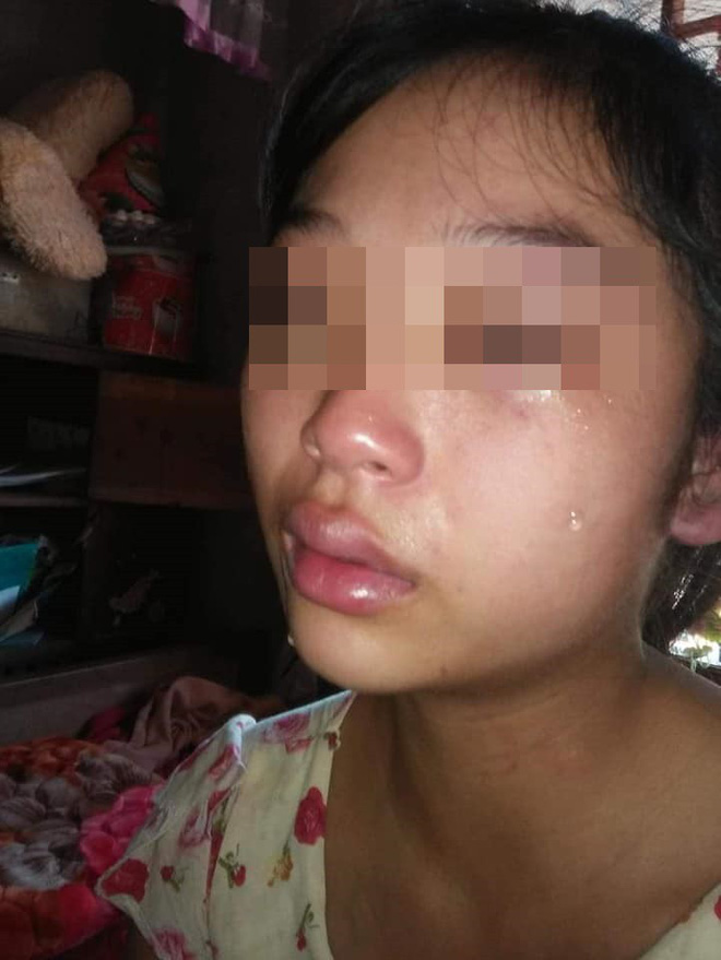 Vợ 16 tuổi lên MXH tố chồng bạo hành từ lúc mang thai: Công an Quảng Bình vào cuộc 3