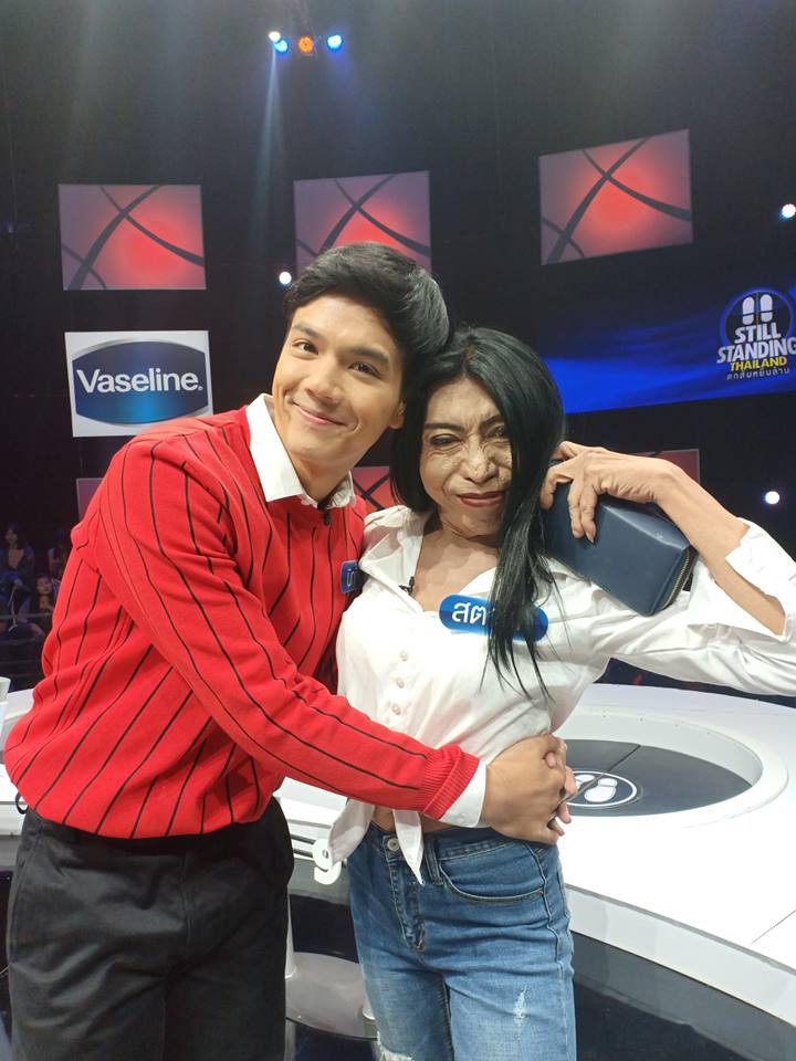 Hot girl mặt nhàu đình đám MXH Thái Lan đi tân trang nhan sắc và kết quả không khả quan cho lắm - Ảnh 5. 'Hot girl mặt nhàu' đình đám MXH Thái Lan đi tân trang nhan sắc và kết quả không khả quan cho lắm 6