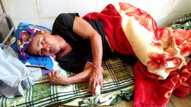 Lão nông bị lợn rừng khủng hơn 1 tạ húc thủng bụng, cắn đứt ngón tay - Ảnh 1. Lão nông bị lợn rừng 'khủng' hơn 1 tạ húc thủng bụng, cắn đứt ngón tay 1