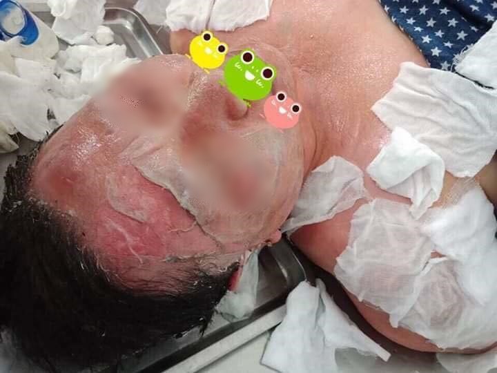 Clip nhân viên spa phủ tấm chăn tẩm cồn lên người khách rồi châm lửa: Phương pháp làm đẹp mới khiến nhiều người hoang mang? - Ảnh 3. Clip nhân viên spa phủ tấm chăn tẩm cồn lên người khách rồi châm lửa: Phương pháp làm đẹp mới khiến nhiều người hoang mang? 3