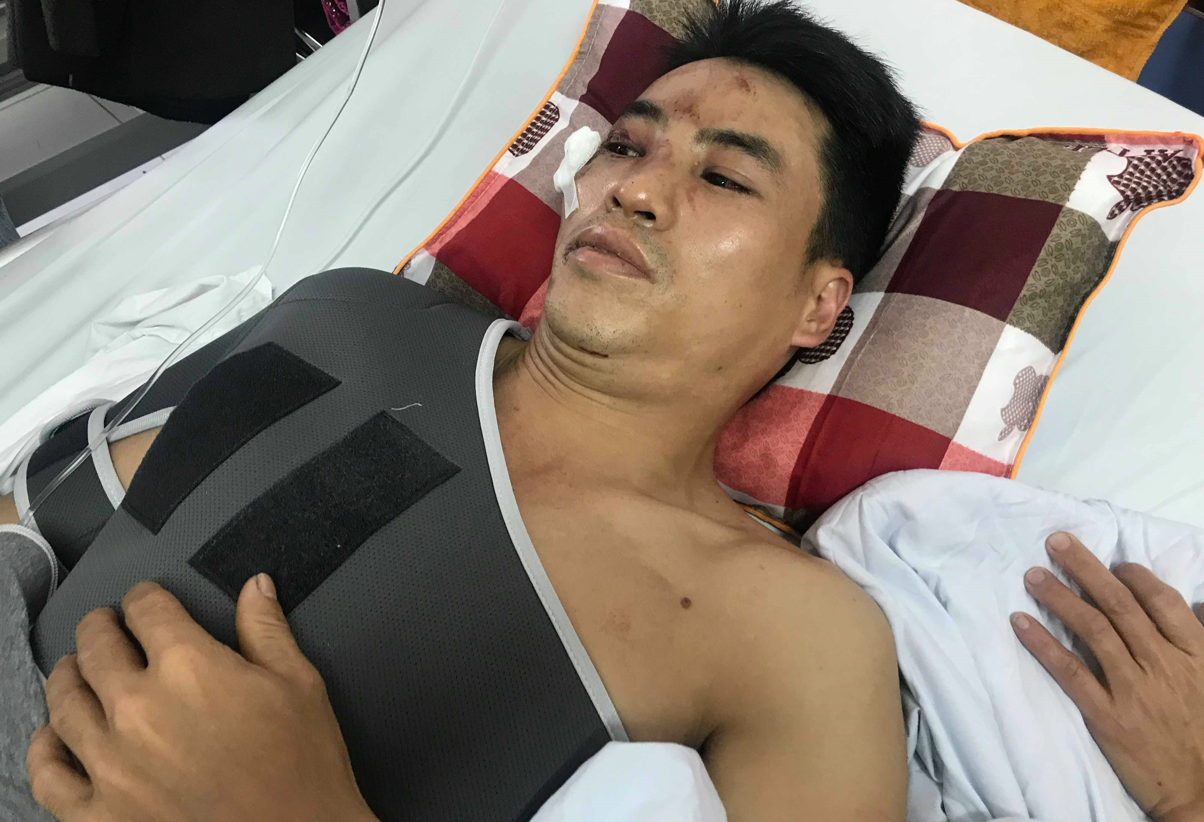 Nạn nhân vụ xe Lexus đâm liên hoàn tại Hà Nội: 'Tôi tưởng mình đã chết rồi' 4