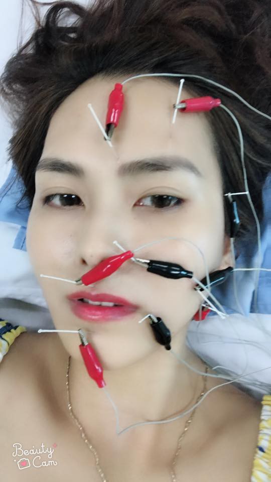 Tâm sự của cô gái xinh đẹp bị... méo mồm chỉ vì cái điều hòa nhiệt độ - Ảnh 1. Tâm sự của cô gái xinh đẹp bị... méo mồm chỉ vì cái điều hòa nhiệt độ 1