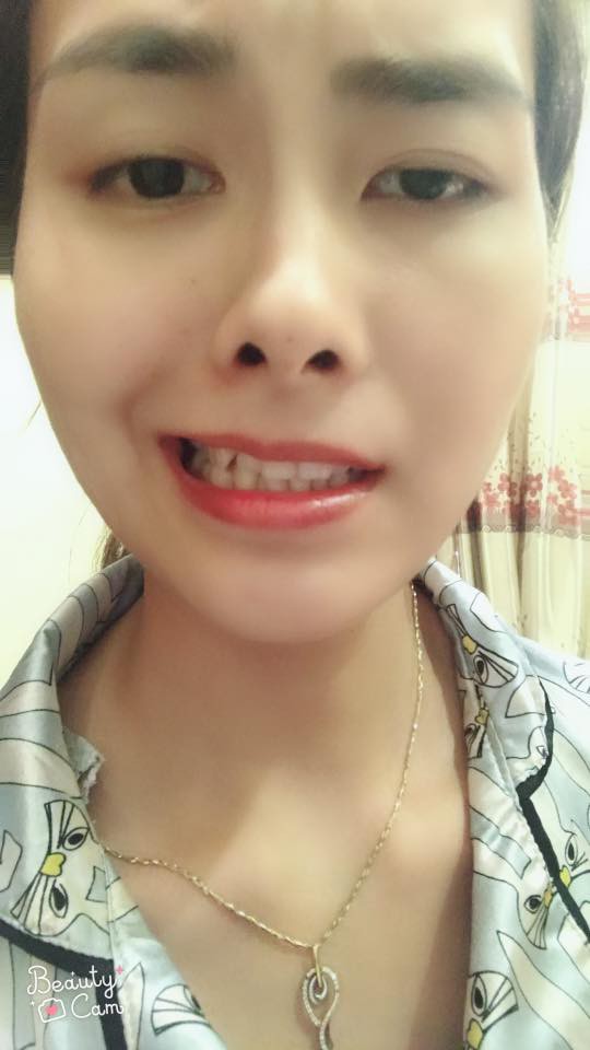 Tâm sự của cô gái xinh đẹp bị... méo mồm chỉ vì cái điều hòa nhiệt độ - Ảnh 2. Tâm sự của cô gái xinh đẹp bị... méo mồm chỉ vì cái điều hòa nhiệt độ 2