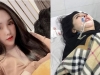 Hà Nội: Điều tra vụ cô gái tử vong sau 2 tháng hôn mê do phẫu thuật nâng mũi