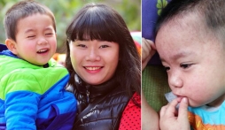 Dịch sởi:  Lo tự cứu con mình đi!