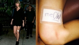 Taylor Swift khoe đôi chân 850 tỷ bị băng bó vì mèo cưng