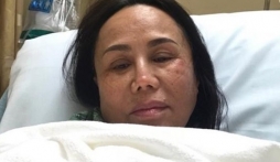 Xót xa danh ca Thanh Tuyền tiều tụy vì gặp tai nạn nghiêm trọng