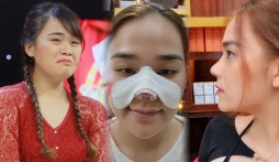 Sửa nhưng không ưng, 'thánh sún' Ngân Thảo hối hận vì đã can thiệp dao kéo: Nhan sắc hiện thế nào?