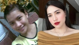 Võ Hà Linh gây bất ngờ với diện mạo 'hai lúa' trước khi thực hiện thẩm mỹ