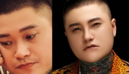 Sau Việt Anh, Vũ Duy Khánh phẫu thuật thẩm mỹ