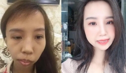 26 năm sống với nỗi bất hạnh đeo đẳng, cô gái đón nhận phép màu giúp thay đổi cuộc đời