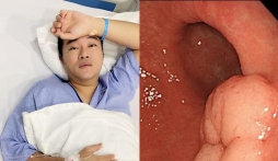 Ca sĩ Minh Quân công khai trình tự cắt bỏ 80% dạ dày vì 1 thói quen xấu: CĐM ‘lạnh gáy’ nghĩ lại mình