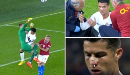 Vừa dính chấn thương tại Nations League, Ronaldo lại bị FA buộc tội 