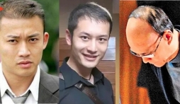 Dàn nam thần Hoa ngữ hói đầu khiến netizen tá hỏa