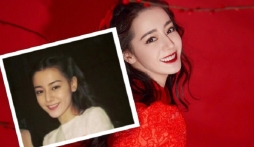 Nhiệt Ba, Na Trát và loạt sao Hoa ngữ khóc hận vì làm răng sứ