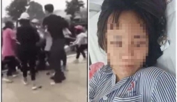 Quảng Ninh: Nữ sinh cấp 3 bị đánh hội đồng giữa quảng trường, chấn thương sọ não