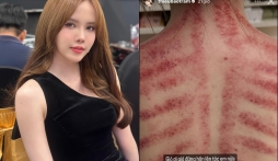 Thiều Bảo Trâm tiết lộ tình hình sức khoẻ khiến fan lo lắng