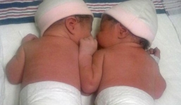 Cặp song sinh chào đời cách nhau...1 năm