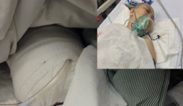 Bắt khẩn cấp đối tượng cắt chân chị gái đang nằm viện