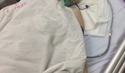 Con gái rủ cậu ruột cắt chân mẹ: Không thể nối lại chân cho nạn nhân