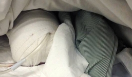 Hoàn cảnh éo le của người bị em trai cắt chân