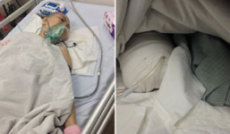 Vụ con gái và cậu ruột cắt chân mẹ: Lãnh đạo bệnh viện khẳng định là có thật