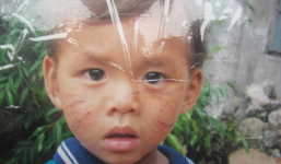 Nghi con rơi của chồng, dùng kéo rạch nát mặt bé hàng xóm