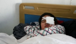 Bị bạn tát 40 cái theo lệnh thầy giáo, nam sinh suýt mù mắt