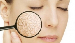 Những thực phẩm huỷ hoại làn da của bạn