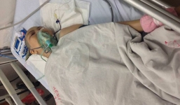 Vụ cắt đứt chân chị gái: Tiên lượng sức khỏe của bệnh nhân rất xấu