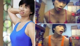 Cận cảnh chàng trai có bộ ngực 'khủng' như phụ nữ